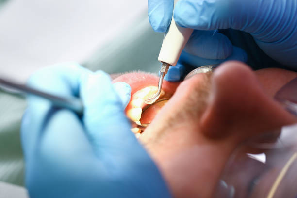 Best After-Hours Emergency Dentist in Church Hill, TN